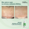 BasicLab Normalizujące Serum Przeciw Zaskórnikom z 5% Azeloglicyny i 1% BHA dla Skóry Problematycznej 30ml
