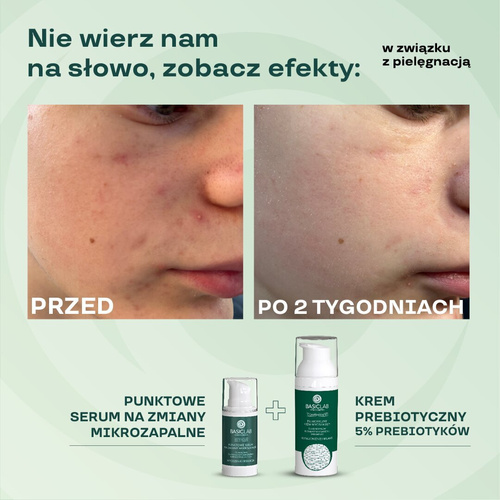 BasicLab Prebiotic Light Calming Cream with 5% Prebiotics 1% Centella Asiatica and Vitamin F Strengthening and Balancing for Problematic Skin Day and Night 50ml