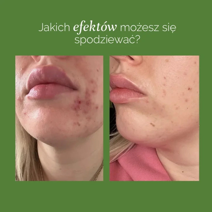 MyBestComplement Tran na Odporność Broskwiniowy 250ml