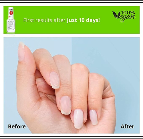 Eveline Nail Therapy Total Action 8w1 Sensitive Skoncentrowana Odżywka do Paznokci Wrażliwych 12ml